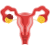 Endometriosis Icon
